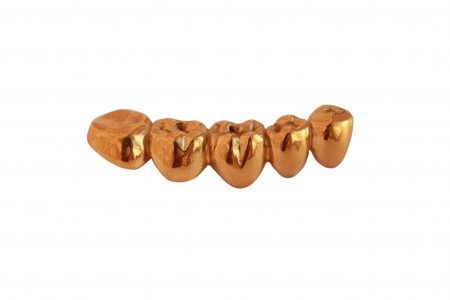dental gold